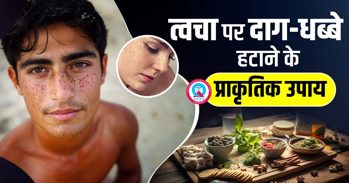 त्वचा पर दाग-धब्बे हटाने के प्राकृतिक उपाय